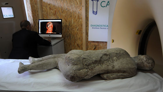  After restoration in one lab, some casts were taken to a second lab to undergo CT scans. The 3-D images created by the scans are revealing details about the individuals’ remains, as well as the condition of the casts themselves. 