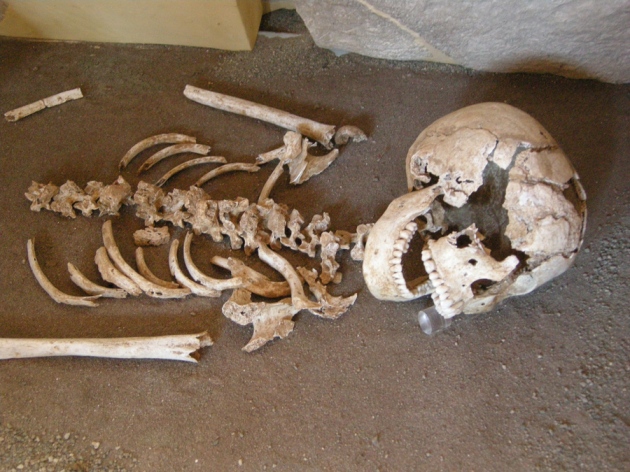 Celiac-Skeleton-Italy