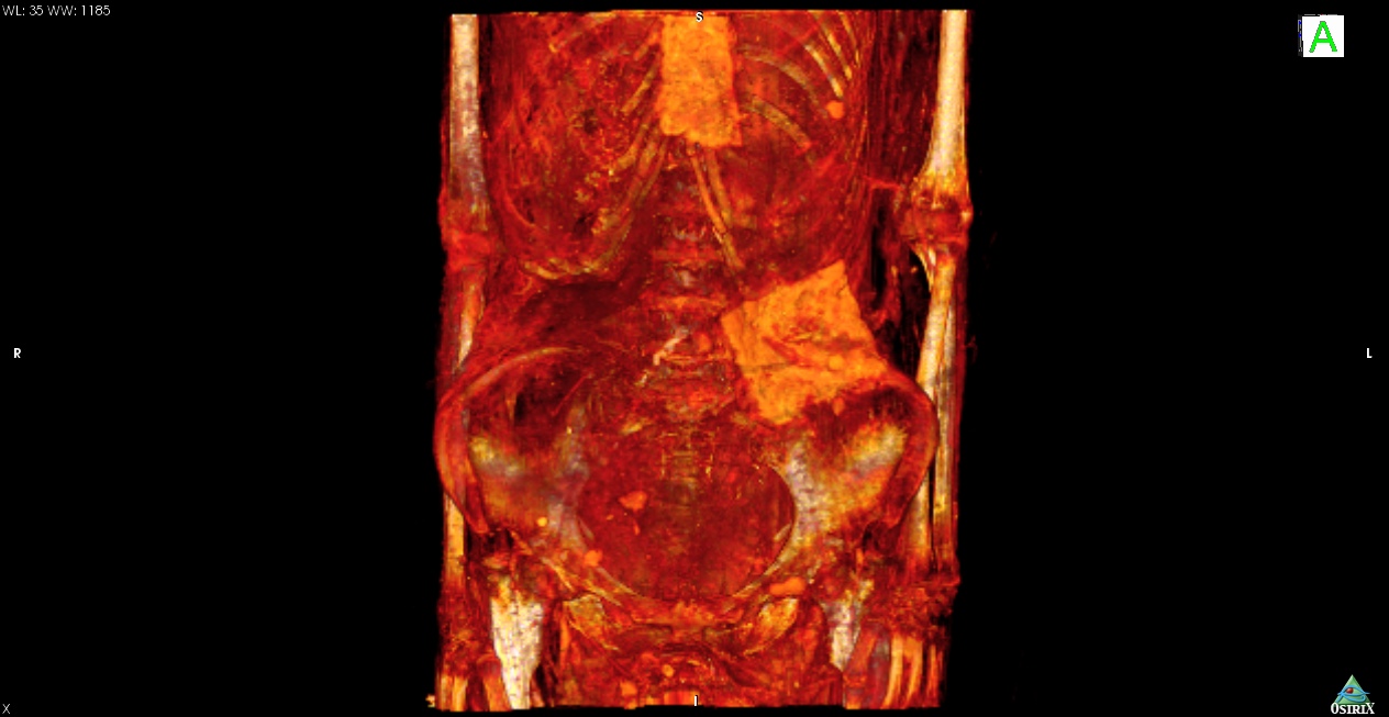 ancient-egyptian-mummy-ct-scan-3