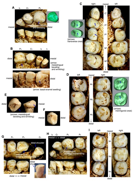 Homo floresiensis teeth