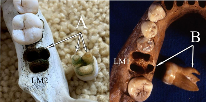 Denisovan Teeth Roots