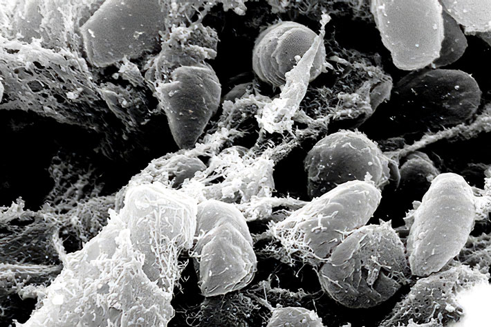 Yersinia Pestis