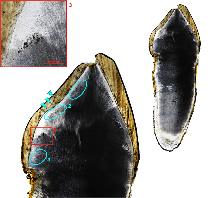 England Permanent Maxillary Canine