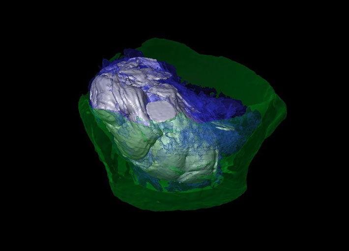 France Coins CT Scans