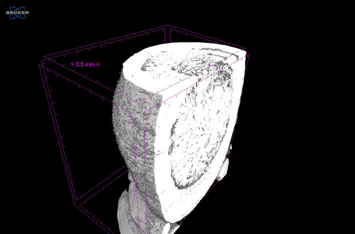 Gallbladder CT Cross Sections