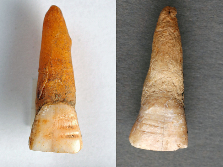 Gotland Viking Incisor Furrows