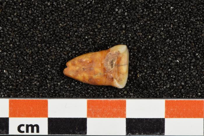 Morocco Human Tooth