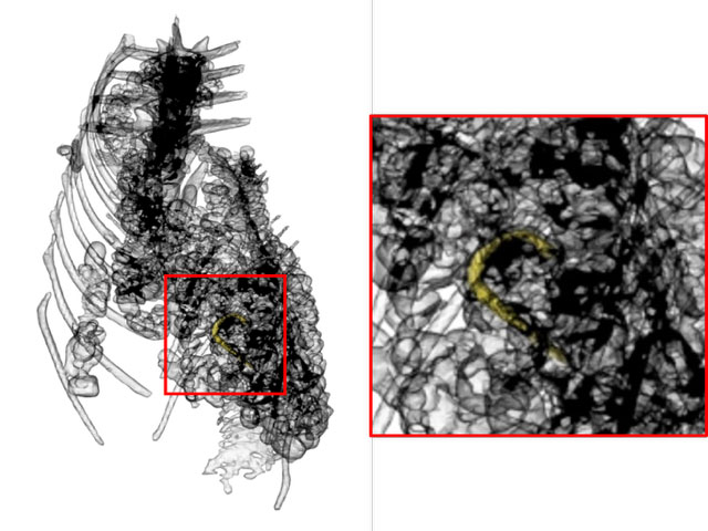 X-ray of fish skeleton showing bronze hook