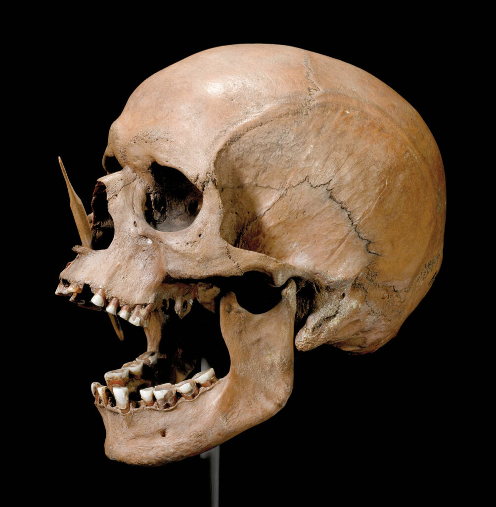 Neolithic skull with protruding arrow point