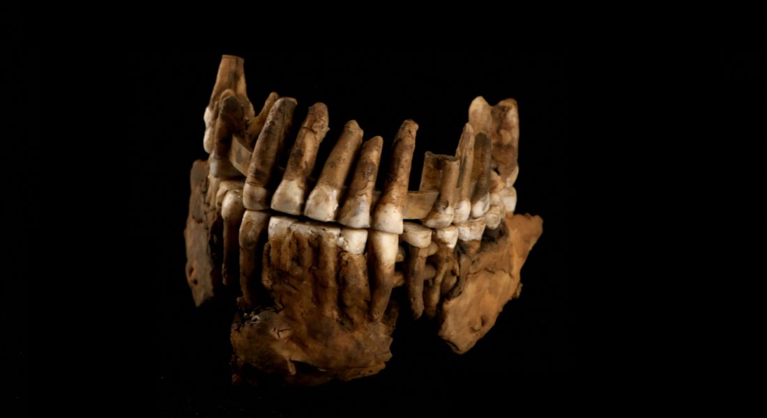 Neanderthal dental remains