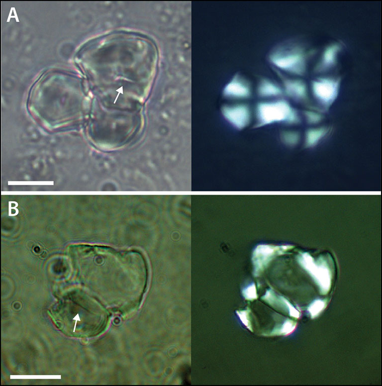 Photomicrographs of starch granules