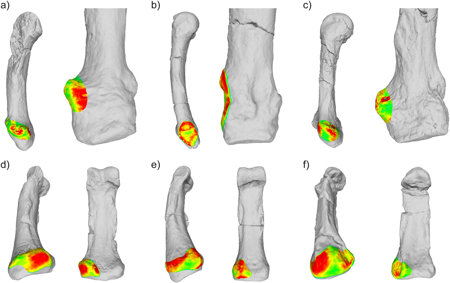 Muscle attachment sites on the fifth metacarpals of hominins