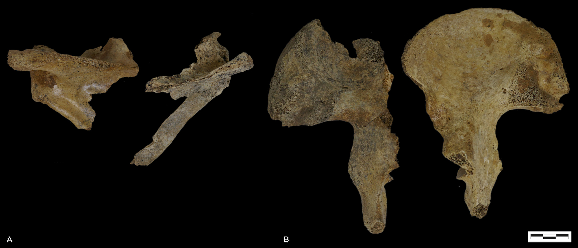 Shoulder blades and hip bones from the skeletal remains unearthed at Pommerœul, Belgium