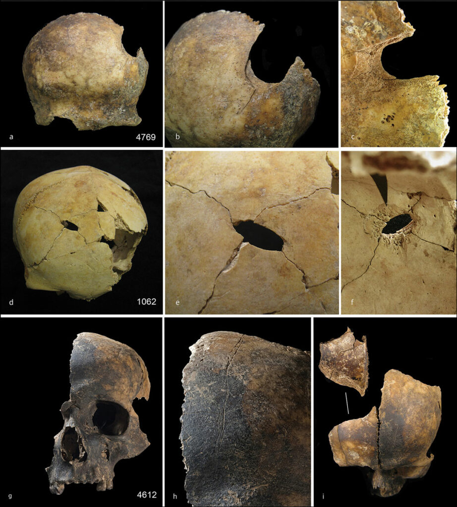 Skulls with evidence of blunt force trauma and cut marks