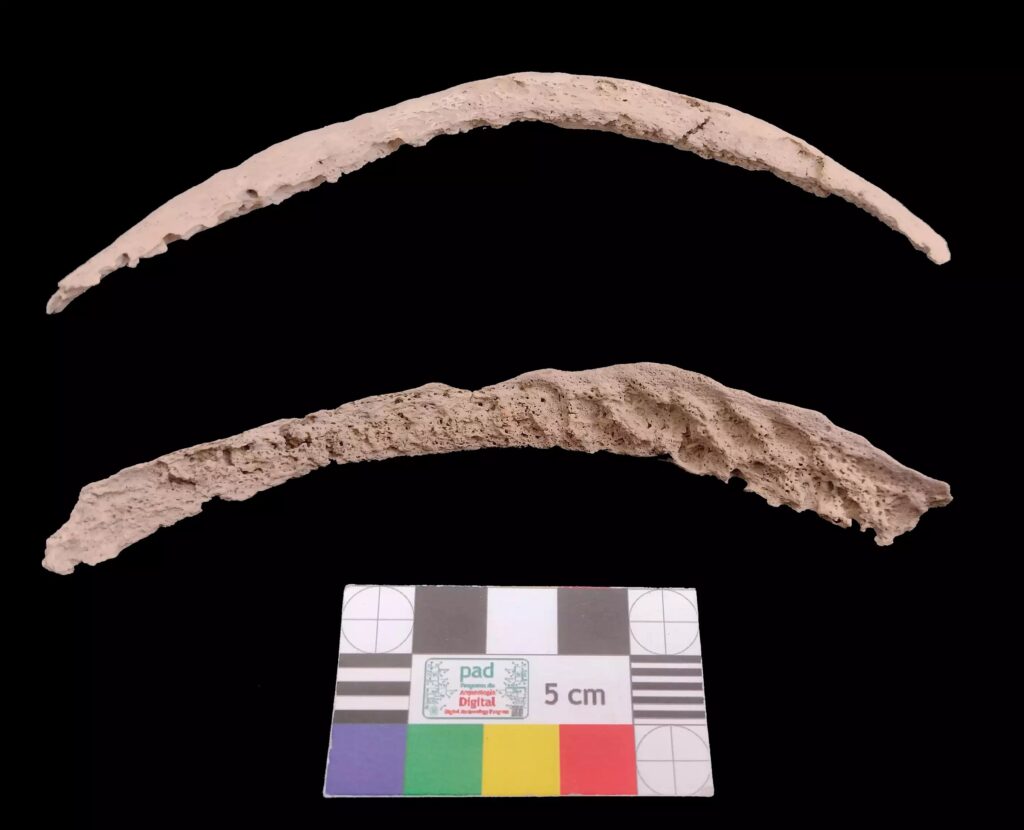 Upper hip bone that yielded an ancient syphilis-like genome