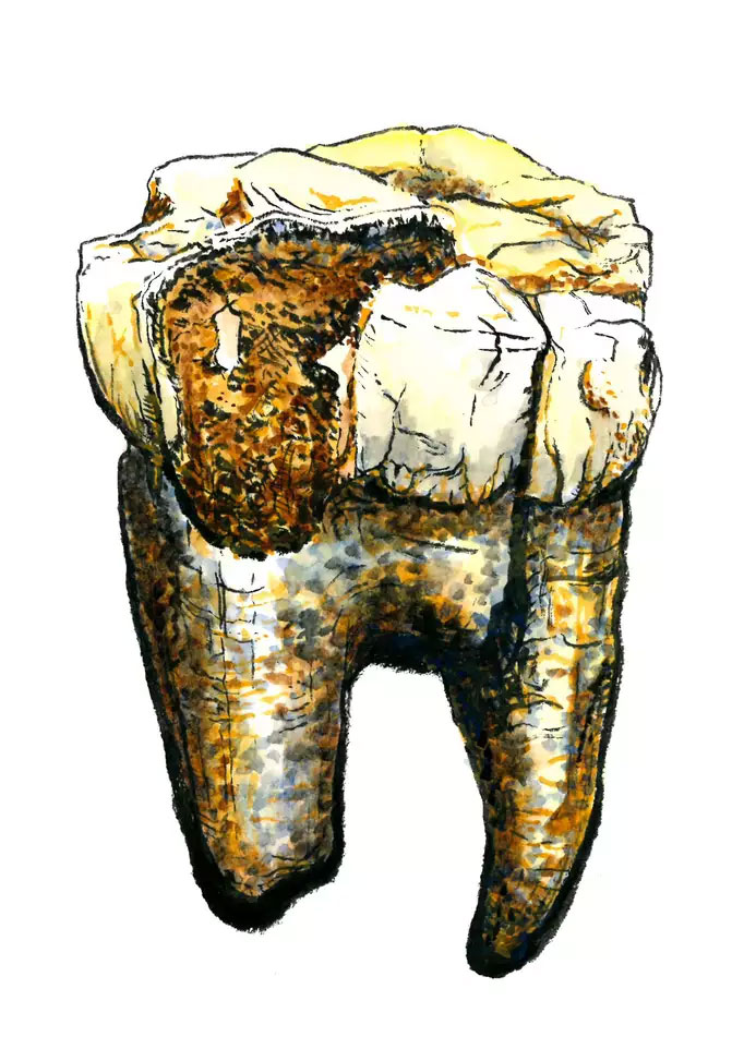 Illustration of one of the seven sampled Australopithecus molars