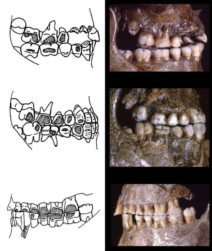 Photographs of cheek teeth (right) from three different Pavlovian individuals and drawings (left) showing hash-marked shapes indicating the areas of enamel that are worn flat