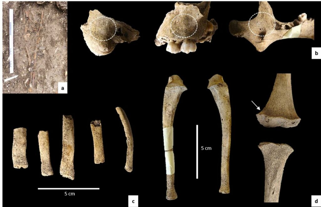 Burial and bones of the child