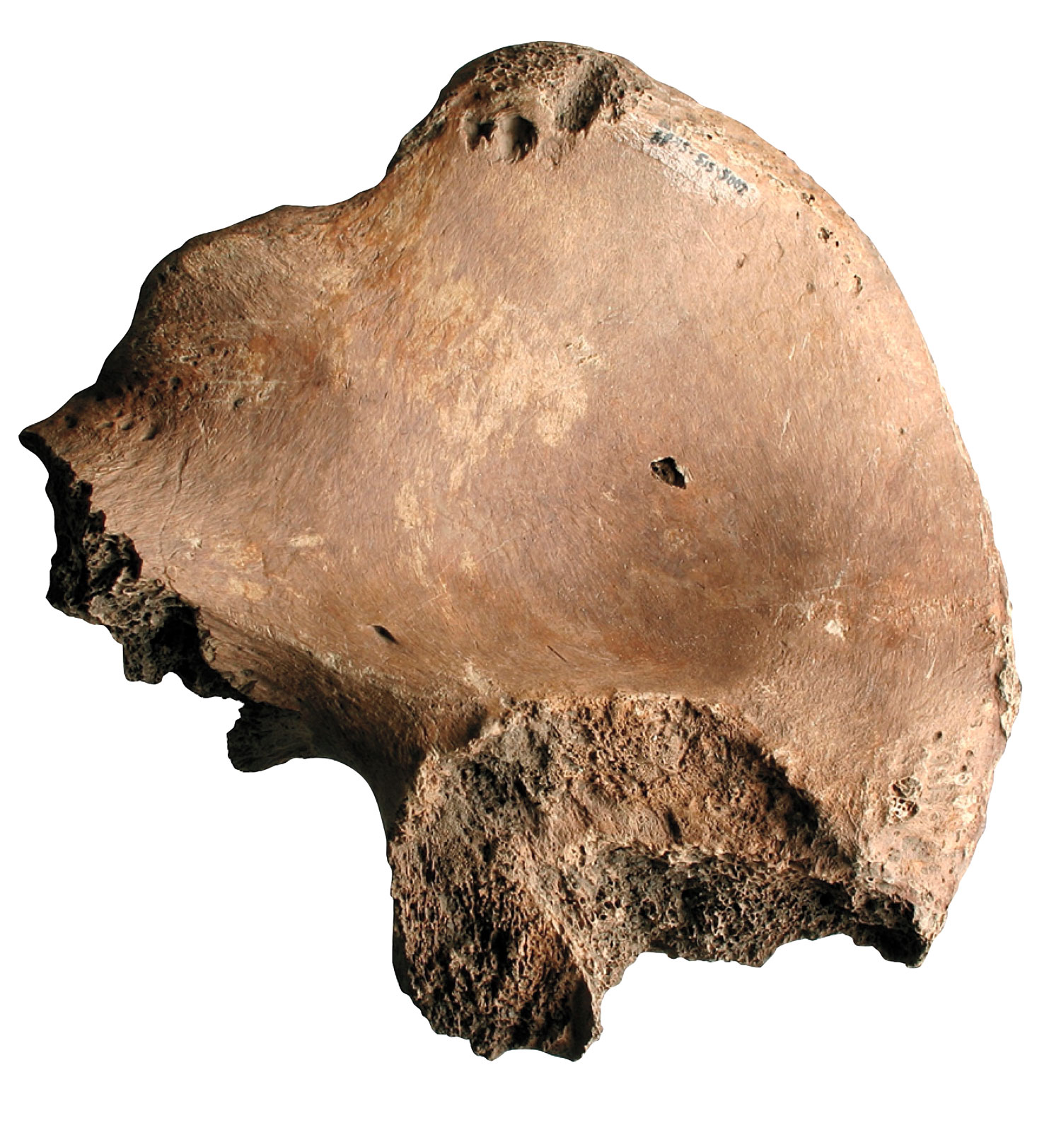 Gladiator's pelvis, York, England