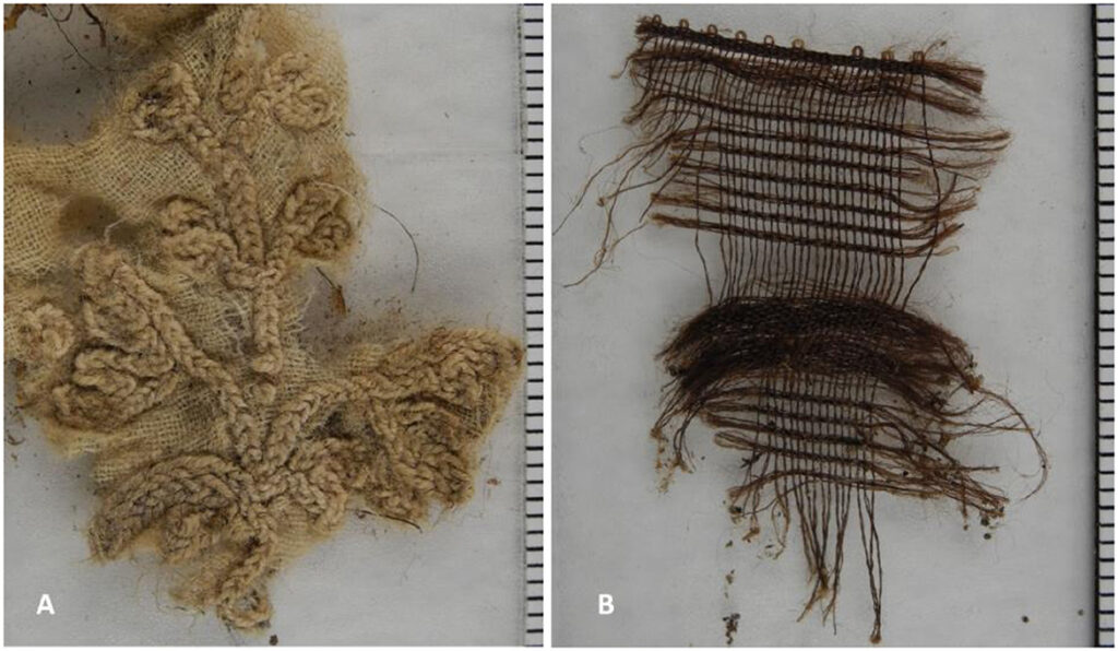 Cotton (left) and silk (right) found inside the abdominal cavity