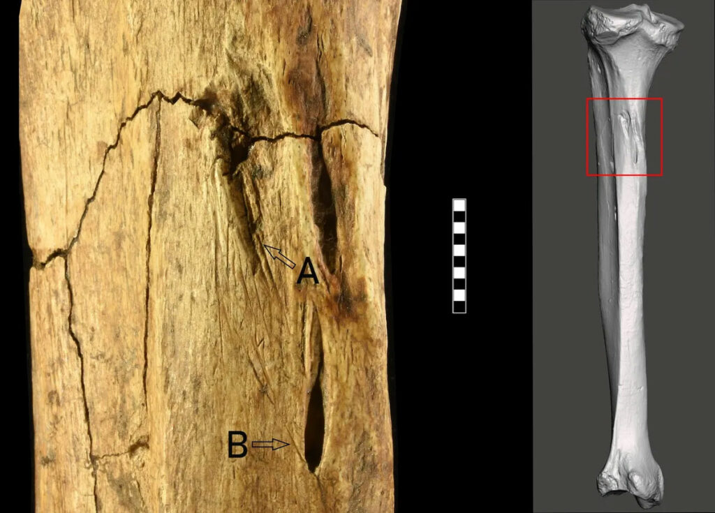 Photograph (left) and 3D surface model (right) showing the locations of lesions on Tagliente 1's left tibia