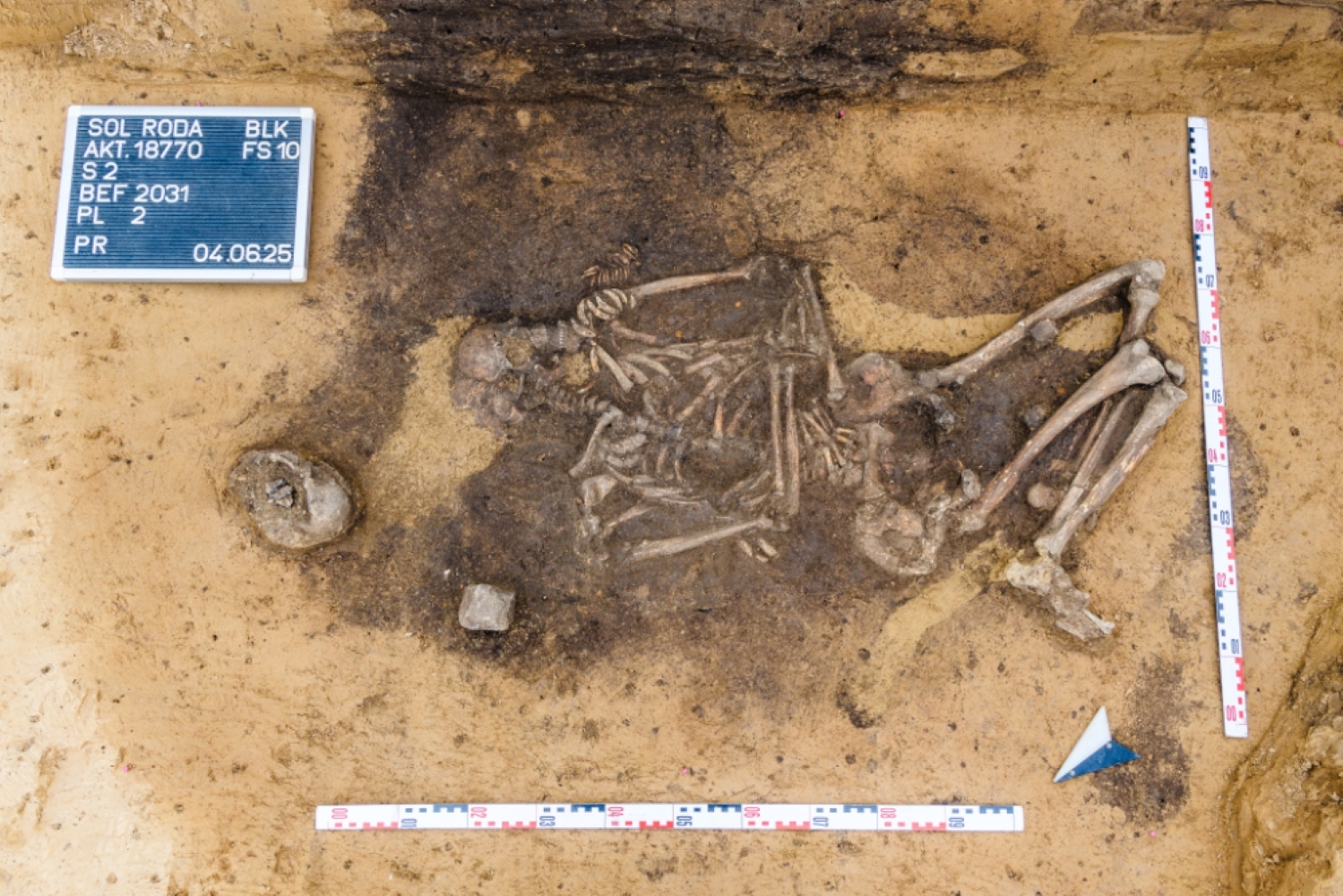 Corded Ware culture grave of a woman buried with numerous animal teeth, Krauschwitz, Germany