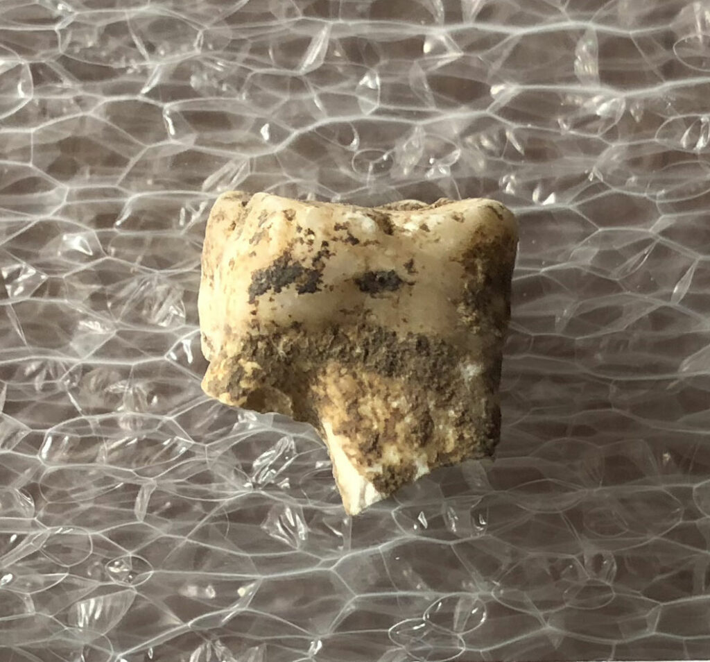 Tooth from which scientists retrieved dental calculus
