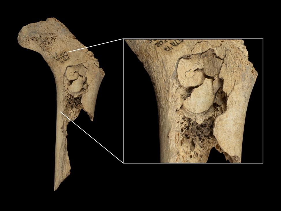 Child femur found in Spain's El Mirador Cave, with impacts to extract the bone marrow