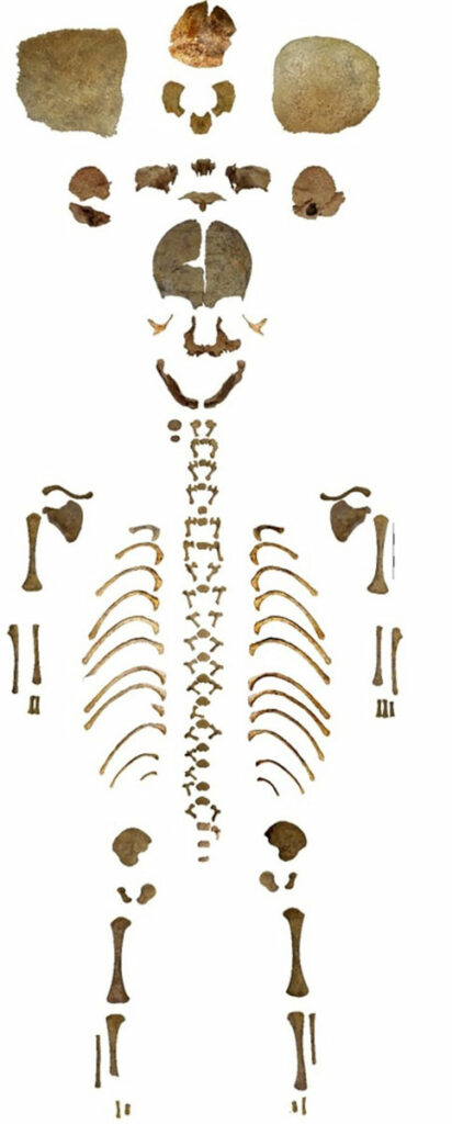 Skeleton of newborn infant