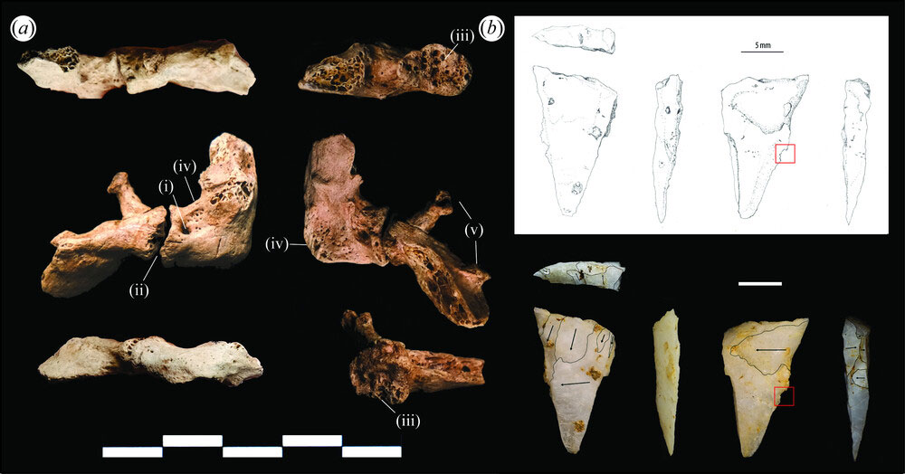 (a) Fracture trauma and evidence of infection to the accessory cervical rib from TBH1, and (b) a quartz micropoint