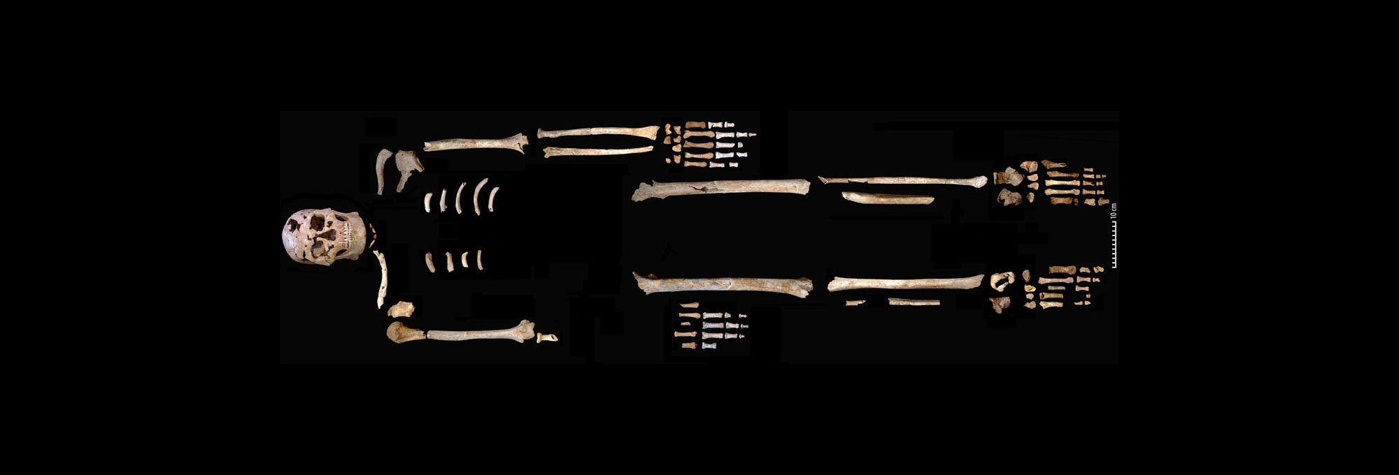 Skeleton of TBH1