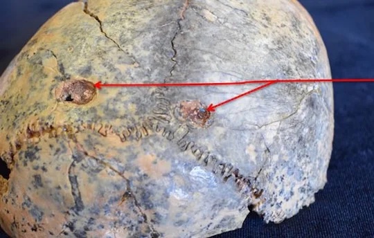 Carnivore marks on Homo habilis skull