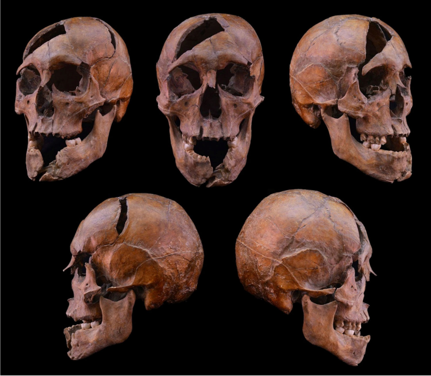 Skull of Duke Béla of Macsó