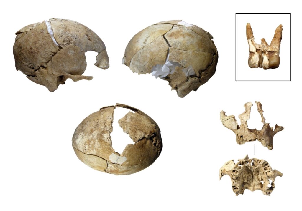 Reconstruction of human skull