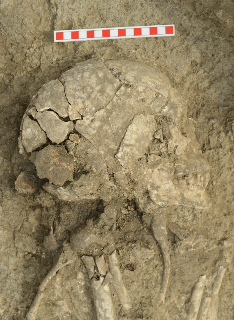 Excavation of human remains with cranial lesions, Kozareva Mogila, Bulgaria