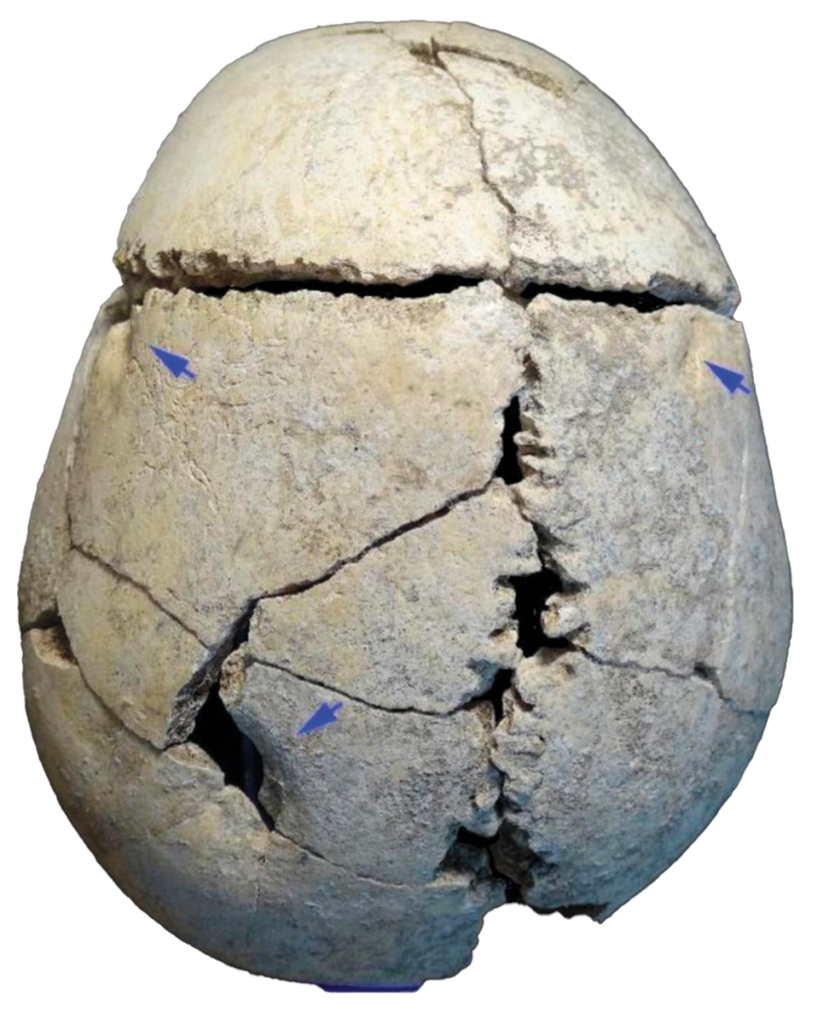 Skull of teenaged boy with arrows pointing to wounds from a lion attack