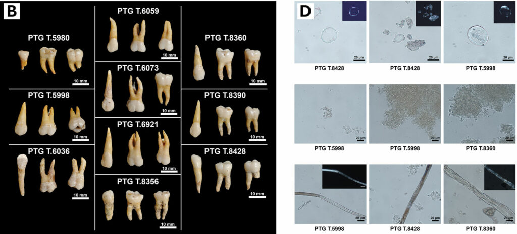 Dental samples (left) and microscopic images of remains extracted from dental calculus (right)