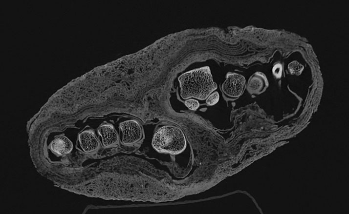 CT scan image of a mummy bundle containing a pair of feet