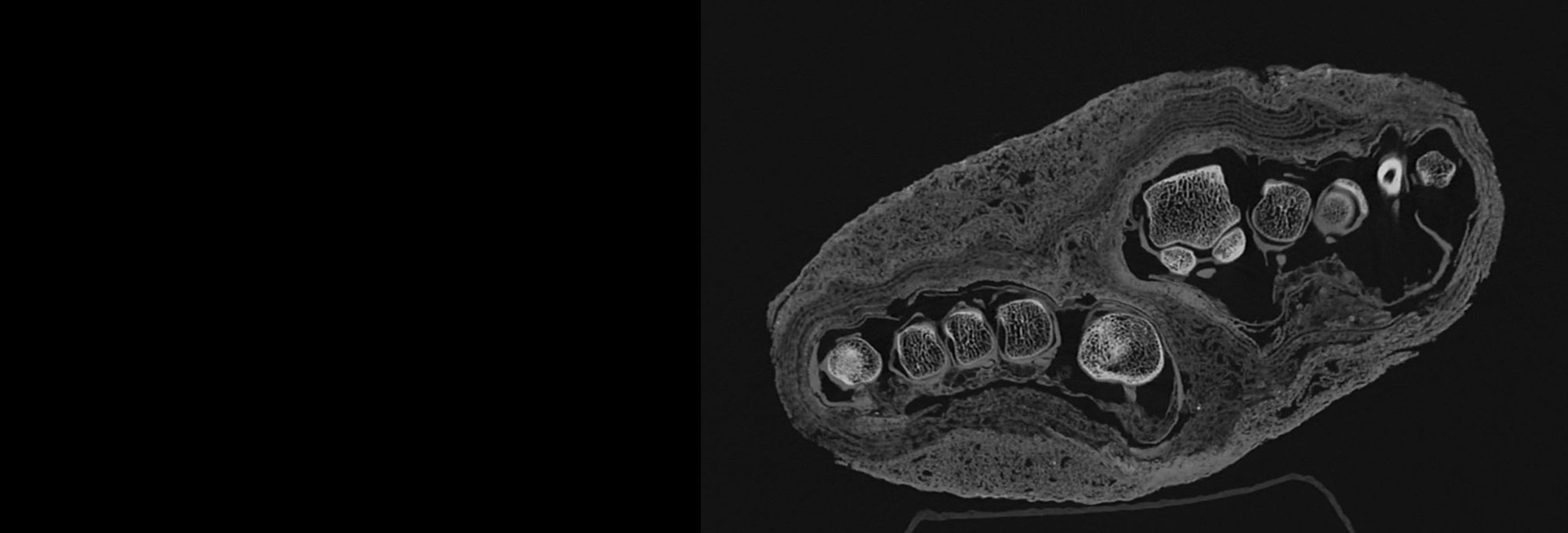 CT scan image of a mummy bundle containing a pair of feet