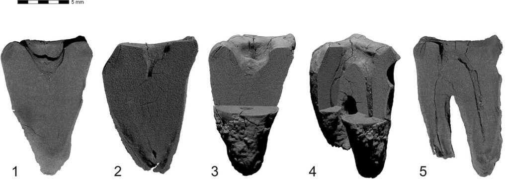 CT scan of Neanderthal molar