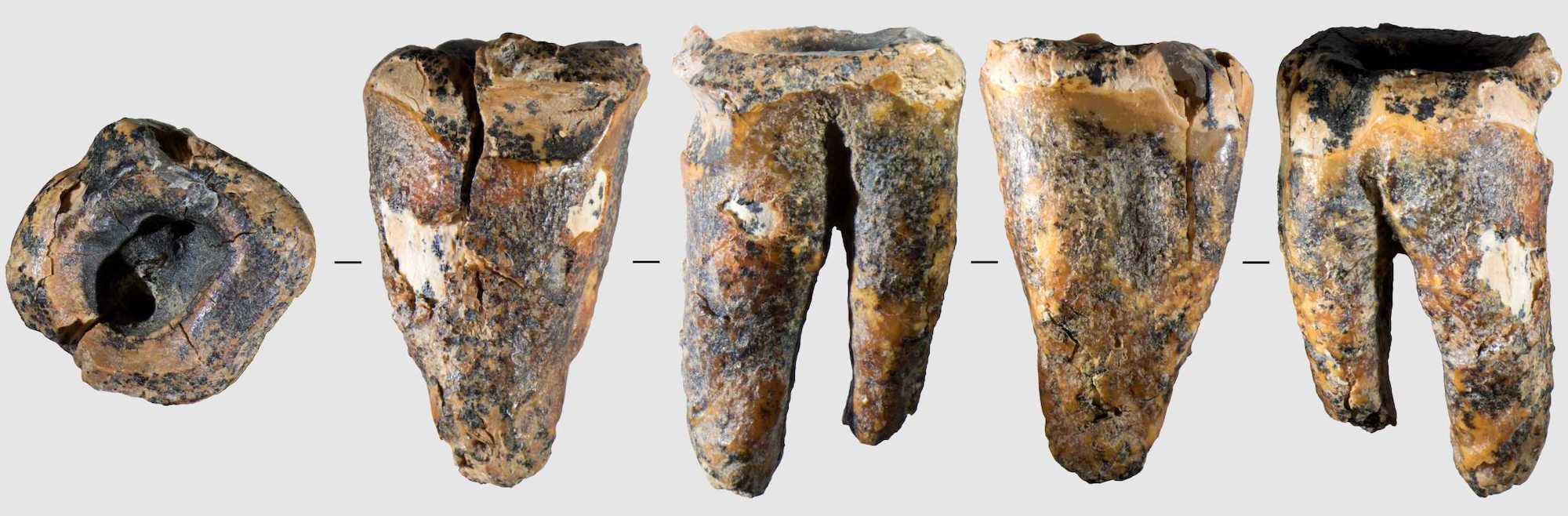 Five views of Neanderthal molar