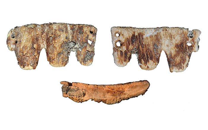 Macro stereomicroscopic images of dental bridge