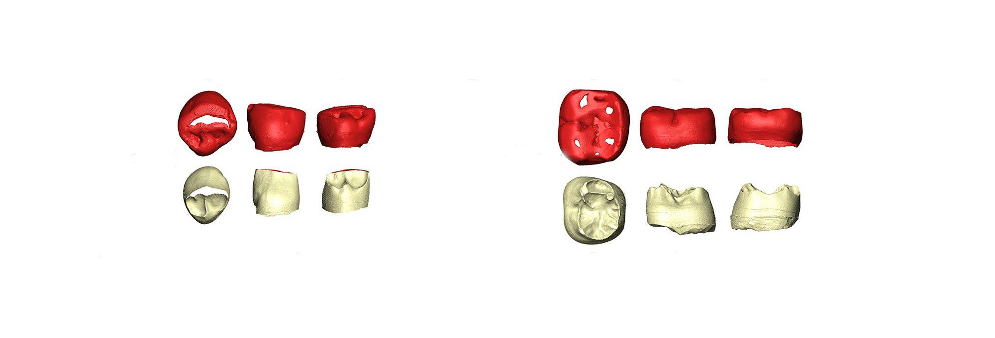 Neanderthal teeth recovered from the Payre site in France