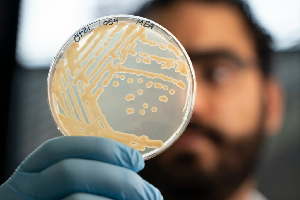Detail of colonies of yeast taken from a sample of &Ouml;tzi&rsquo;s stomach in a petri dish