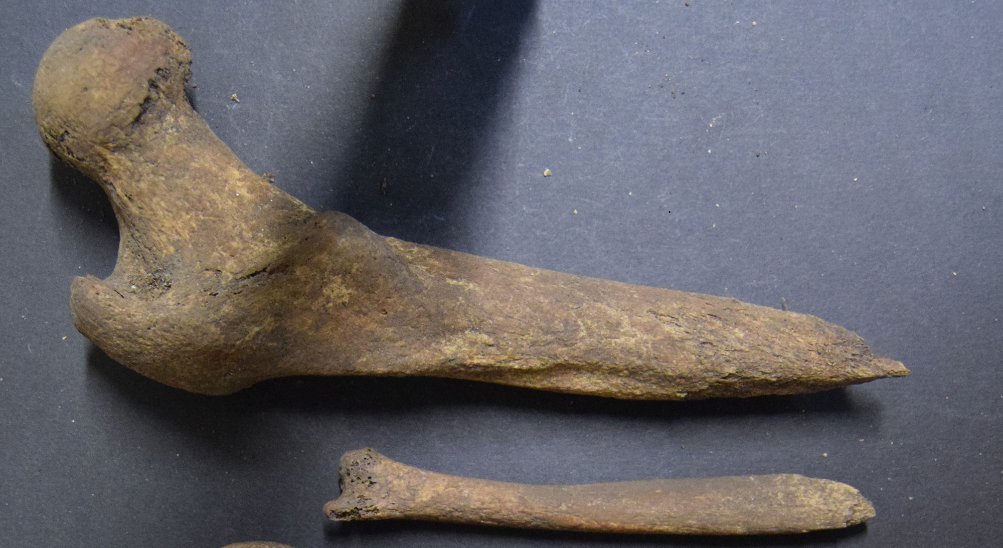 Long bones