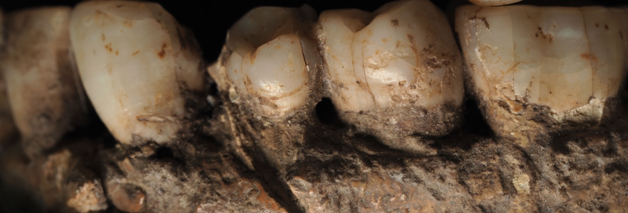 Closeup of teeth from Qafzeh 25 mandible