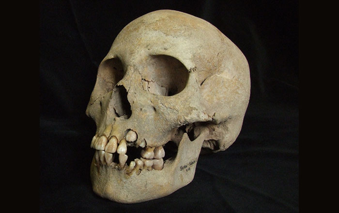 Skull