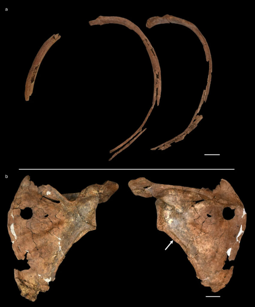 Ribs (top) and scapula (above) of Shanidar A